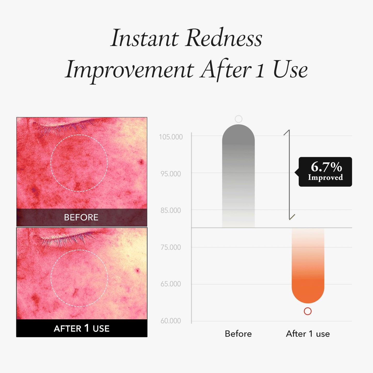 APRILSKIN Carrotene IPMP™ Instant Calming Serum Toner Pads | 5-Minute Cooling Serum Pads | Vegan, Cruelty-Free | Non-comedogenic | Toner-Serum-Sheet Mask All-in-one | Korean Skin Care, 80 Pads