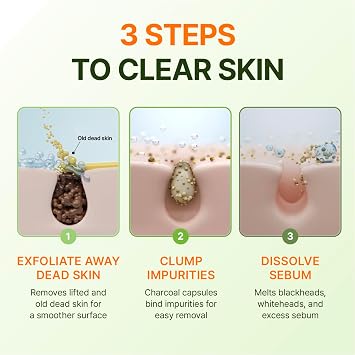 CENTELLIAN 24 Madeca Matcha Toning Peeling Gel - Facial Exfoliator Facial Exfoliator with Matcha-TECA, Charcoal Capsules and Cellulose for Smooth Texture, Sebum Care and Clarity, 5.07 fl oz