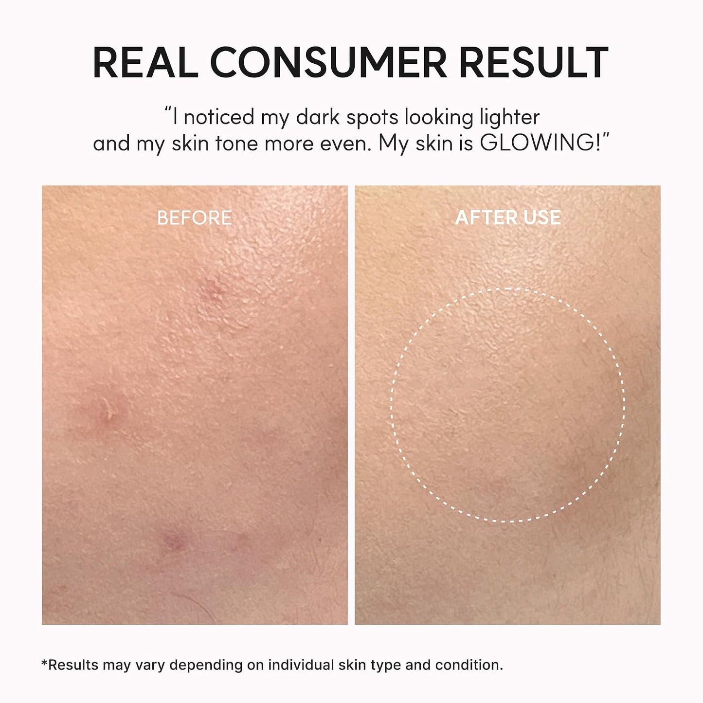 Arencia TXA Booster Shot Serum with 5% Tranexamic Acid & Peptides, Skin Tone Balancing & Hydration Support, Lightweight Daily Skincare