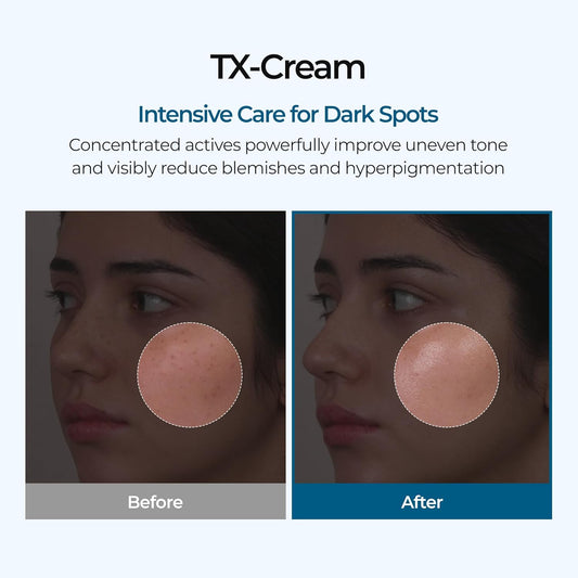 Dr.Melaxin TX Tranexamic Acid CREAM -Skin freckle Cream, Blemishes, Anti-pigmetation korean skin care, Korean Cosmetics