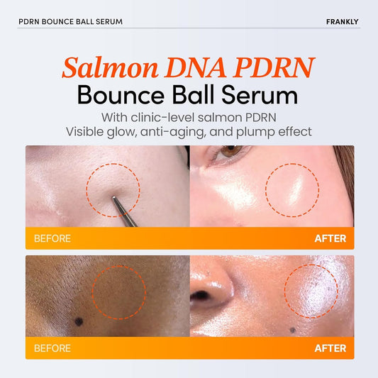 FRANKLY Salmon PDRN Bounce Ball Serum – 99% Pure Salmon DNA PDRN for Post Microneedling Recovery, Redness & Damaged Skin Repair | Glass Skin Korean Skincare | Lightweight, Non Sticky