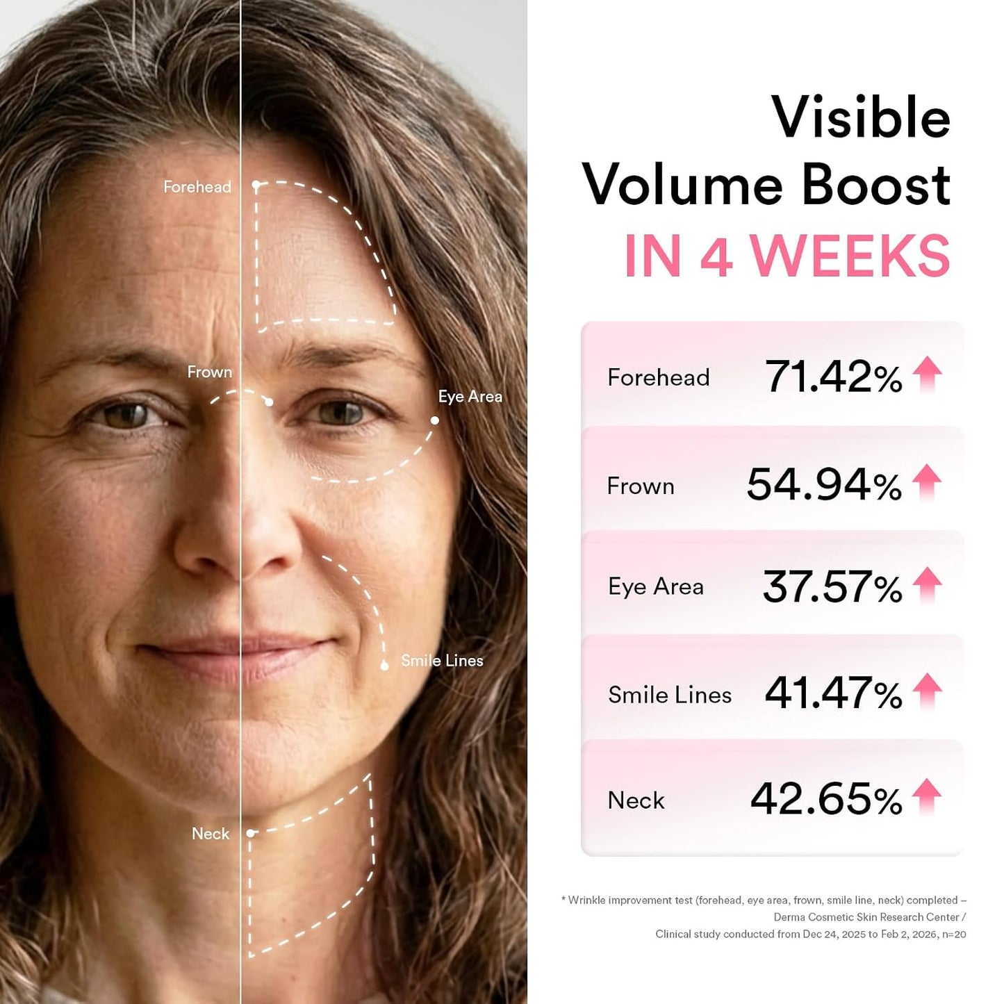 Abib PDRN Volume fill-it Booster Cream 2.5 - Facial Volume Plumping with PDRN 15,000ppm Peptides Retinal, For Forehead, Smile Lines & Neck Wrinkles, Anti-Aging Firming