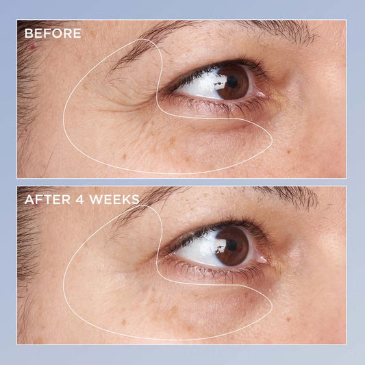 Perricone Md High Potency Triple Retinol Renewal Eye Serum