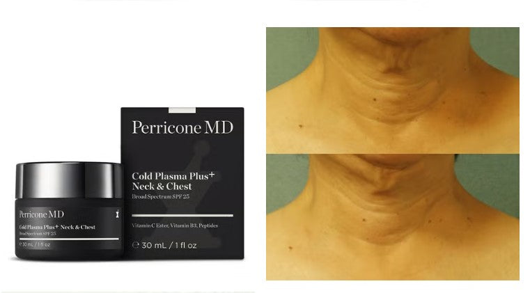 Perricone MD Cold Plasma Plus+ Cuello y Pecho FPS 25 de amplio espectro