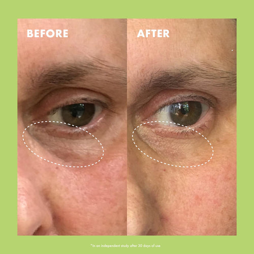 Crema iluminadora para ojos con niacinamida y cafeína Kopari