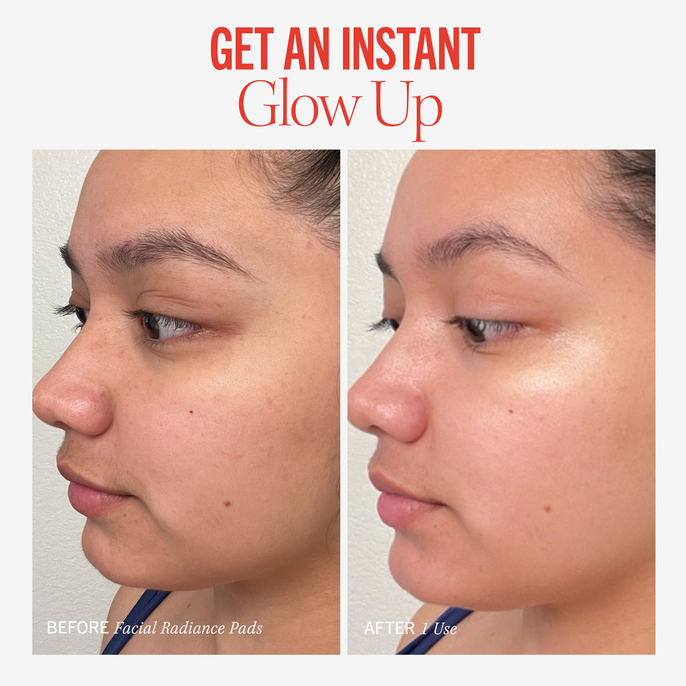 Discos faciales radiantes First Aid Beauty con ácidos glicólico y láctico