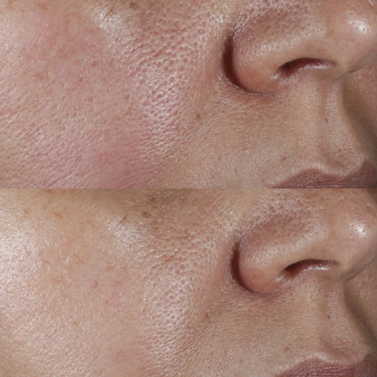 Perricone MD No: Rinse Intensive Pore Minimizing Toner/Lotion - Exfoliates and purifies skin