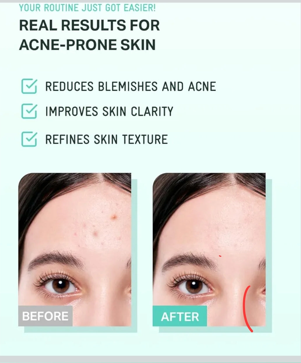 BRINGGREEN Tea Tree Cica Soothing Cream Plus - Korean Skin care, calming and soothing, moisturizer for skin, facial cream, trouble care, blackhead removing pore care