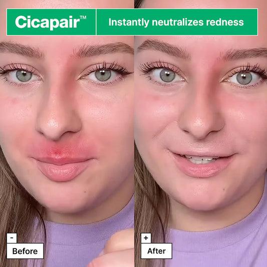 Dr. Jart+ Cicapair Tiger Grass Color Correcting Treatment SPF 22 - Helps soothe, calm, and moisturize the skin it also protects skin from the sun with mineral SPF