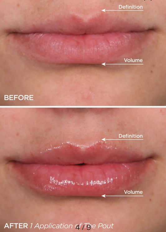 BeautyBio 5 - Star Faves Set - Complete travel size skincare routine to help cleanse, treat, brighten, and regulates oil & reducing redness