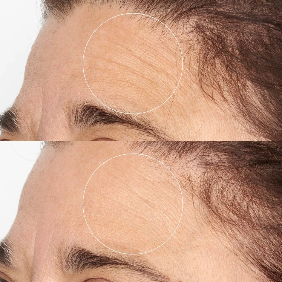 Perricone MD High Potency Intensive Smoothing Serum -
Visibly smooths rough skin texture for a more refined, even-looking complexion
