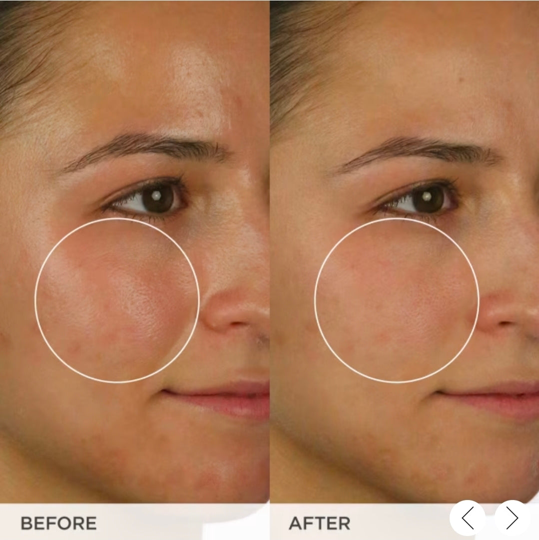 Tatcha The Matcha Cleanse Daily Clarifying Gel Cleanser, Decongests Pores and Balances Oil For Primed, Shine Free Skin 1.7 oz