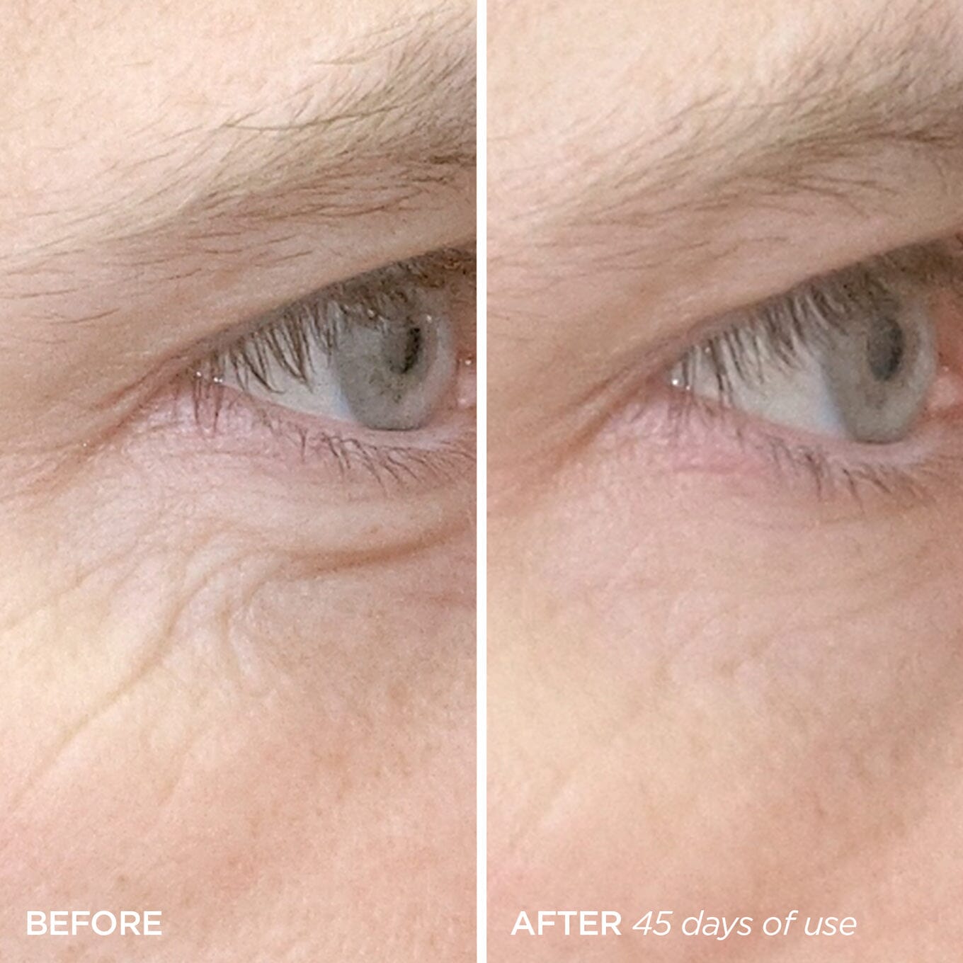 BeautyBio R45 The Reversal - Retinol Anti-Aging Treatment Set - 45 Days Multi-Phase Retinol Treatment - Skin Cell Turnover - Tightening, brightening and smoothing patented 3-phase retinol booster treament