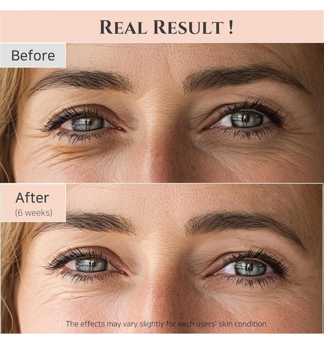 Suero Revive Eye de Beauty of Joseon con ginseng y crema para ojos Retinal Awakening - Para ojeras