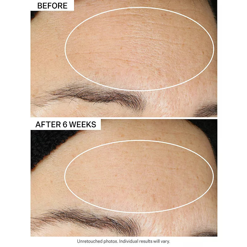 StriVectin Multi-Action Super-B Barrier Strengthening Oil