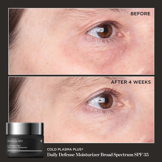 Perricone MD Cold Plasma Plus+ Daily Defense Moisturizer Broad Spectrum SPF 35 - Reduces discoloration, blotchiness, uneven tone and redness