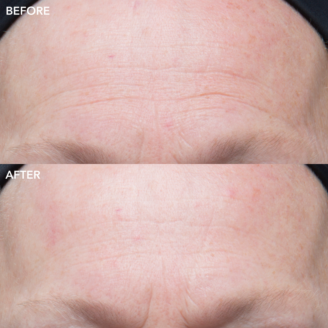 Algenist GENIUS Ultimate Anti-Aging Vitamin C+ -  Fine lines, age spots and discoloration to reveal brighter, radiant, even-skin tone