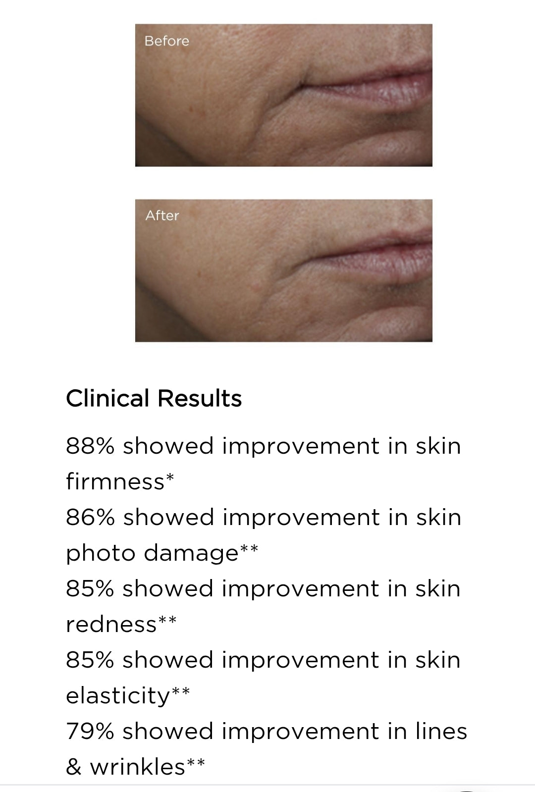 Perricone MD Vitamin C Ester Amine Iluminador Lifting Facial