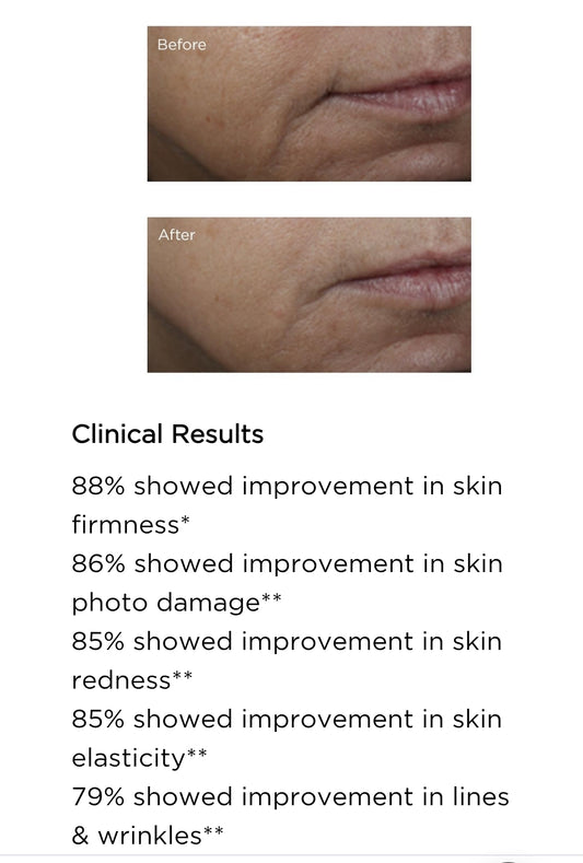 Perricone MD Vitamin C Ester Brightening Amine Face Lift - Minimizes the look of discoloration and sagging skin while brightening and smoothing