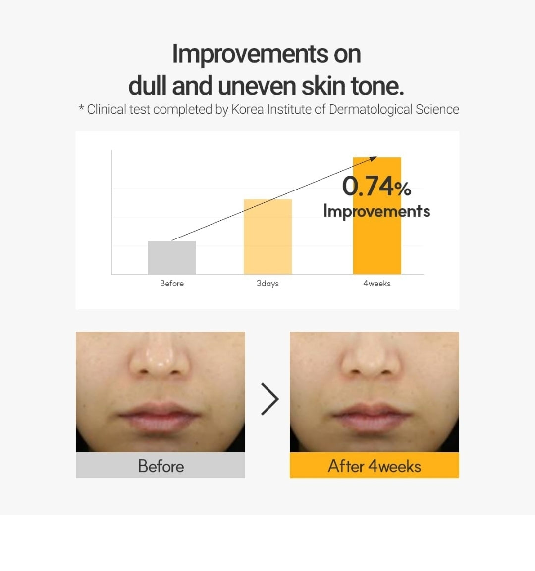 ROVECTIN Vita Brightening Dark Spot Serum - Clearing Blemish and Evening Skin Tone - Rich Vitamin C, Brightening, Hydrating