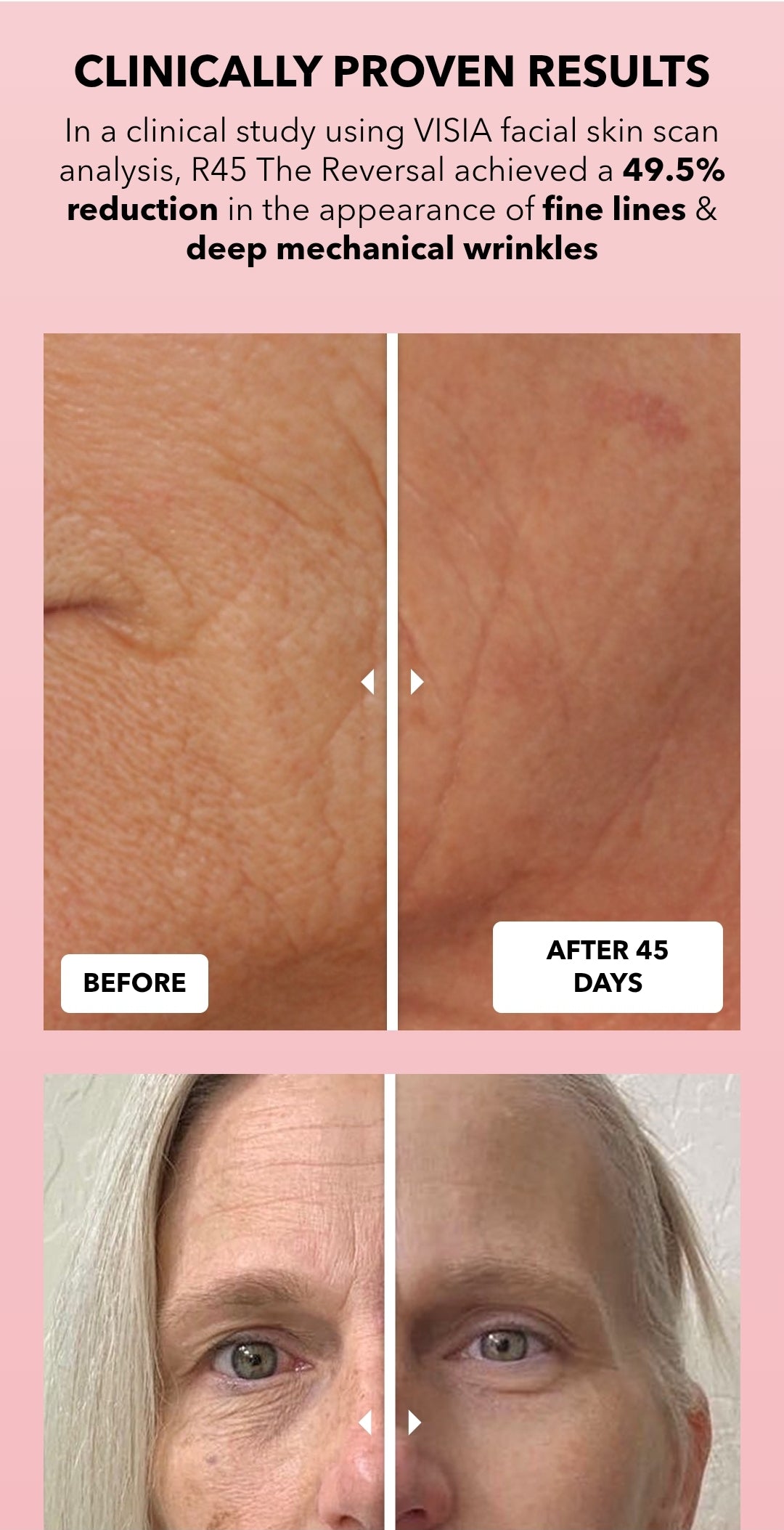 BeautyBio R45 The Reversal