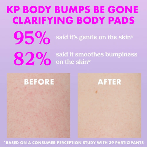 Kopari KP Body Bumps Be Gone - Clarifying Body Pads 4.4% AHA & Aloe Vera - Targets rough texture, dark spots, acne & KP