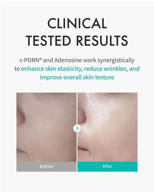 REJURAN Turnover Mask – Premium Care with c-PDRN. Original Salmon DNA Daily Mask for Firming, Hydration, Repairing & Revitalizing. Youthful Radiant Skin - 1 Mask