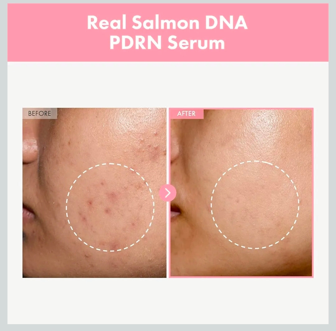 TOSOWOONG Pink Peptide 12 PDRN Serum - With Salmon DNA PDRN 10,320ppm, 12 Peptides, Niacinamide, Skin glow, Hydrating, Moisturizing, Firming, Uneven Skin Tone