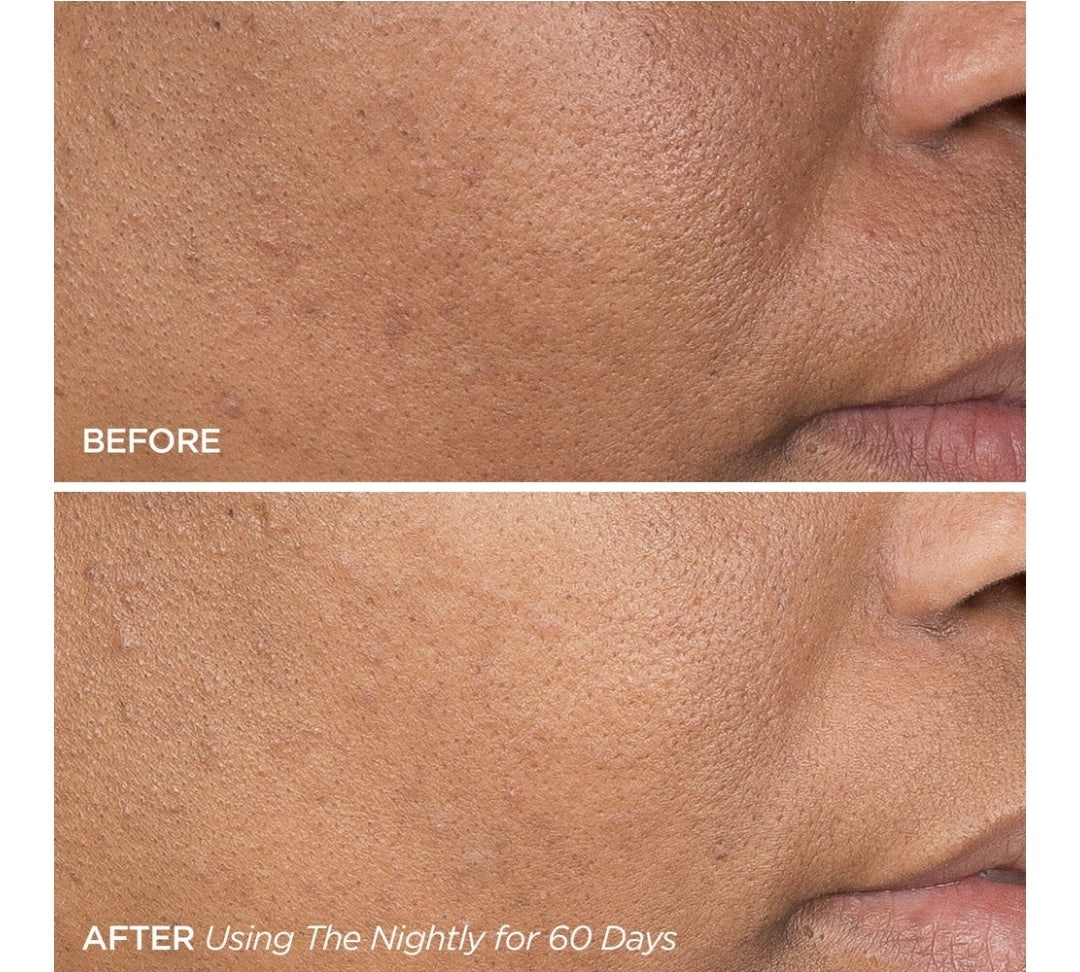 BeautyBio The Nightly - Suero reparador de retinol de noche reafirmante y suavizante