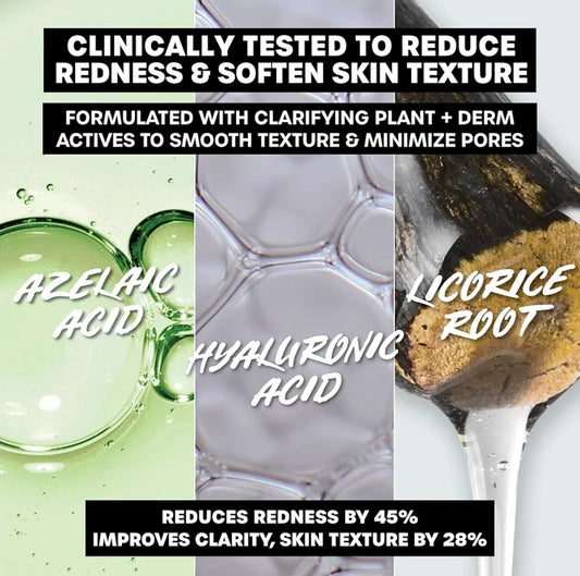 THAYERS Let's Be Clear Water Face Cream - Moisturizer with Azelaic Acid and Hyaluronic Acid, Skin Care for Oily to Combination Skin