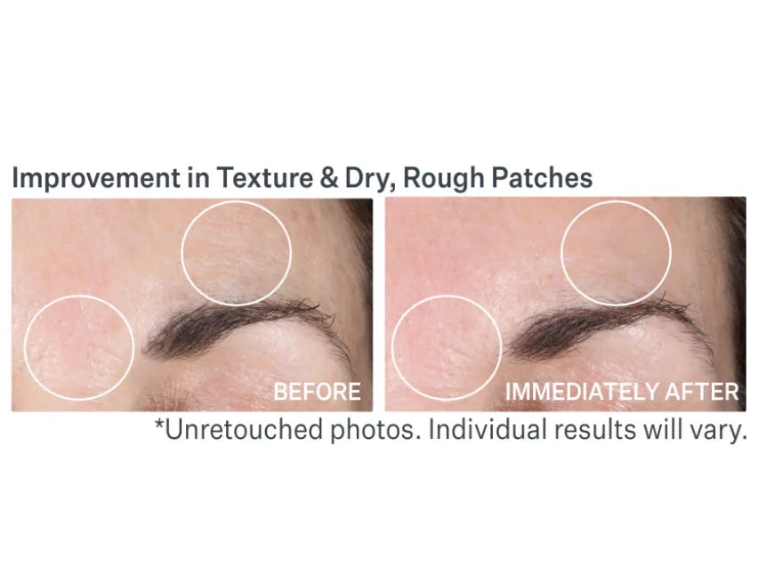 Strivectin Advanced Resurfacing Pro Glowfoliant Mix-In Microderm Crystals