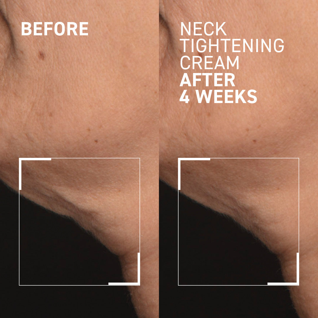 Crema reafirmante para el cuello Dr. Brandt + Gua Sha: crema antiedad para el cuello con Gua Sha, resultados comprobados.