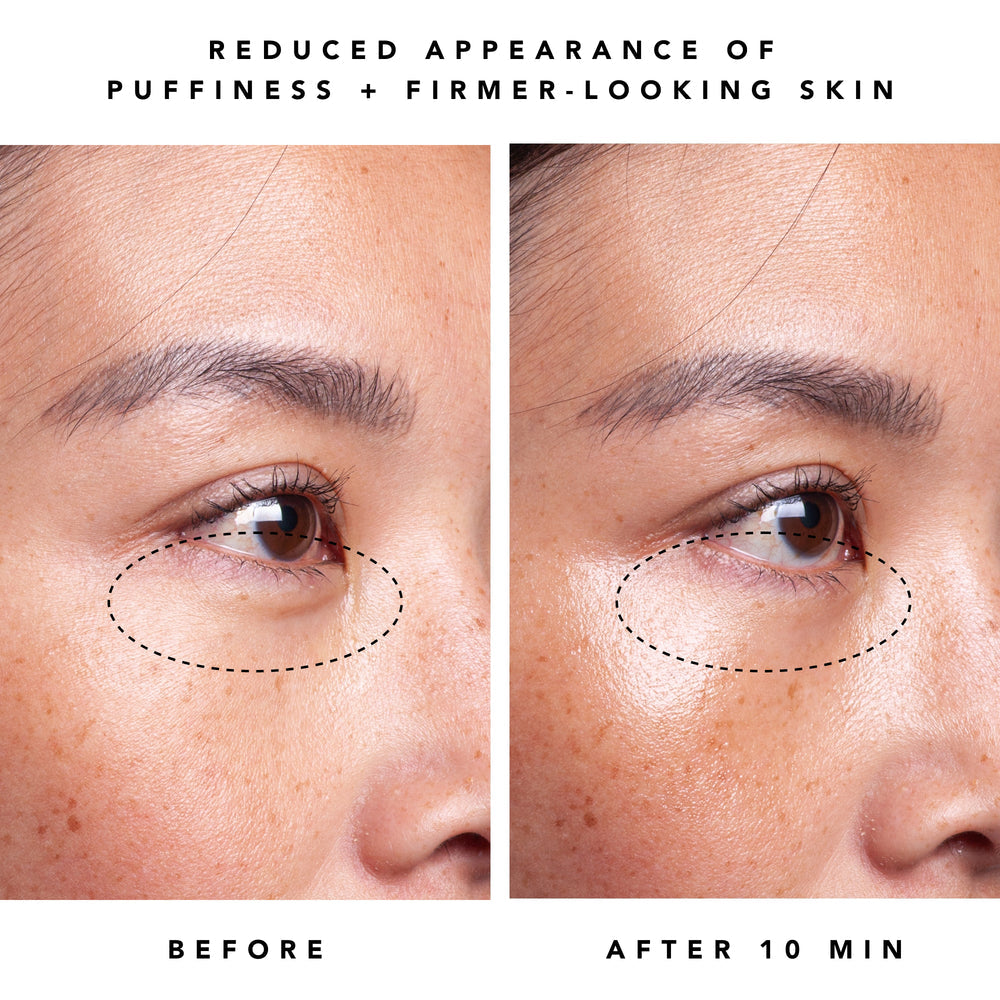 Herbivore Dew 1% Bakuchiol + Peptides Retinol Alternative Firming Eye Cream - Fine lines and wrinkles, Loss of firmness, Dryness, Signs of aging around the eyes