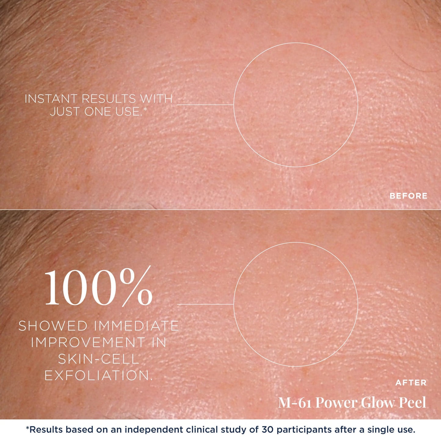 M-61 PowerGlow Peel