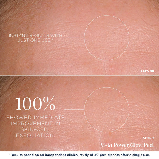 M-61 PowerGlow Peel - Immediately improves skin cell exfoliation. Exfoliates, resurfaces, clarifies, and firms