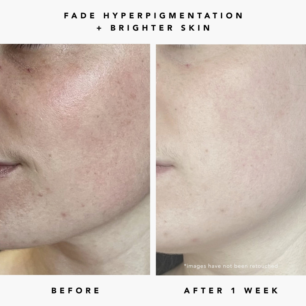Herbivore Milky Way 10% AHA + Oat Soothing Exfoliating Serum - Deeply exfoliates the surface of skin for instant glow and repairs the skin barrier