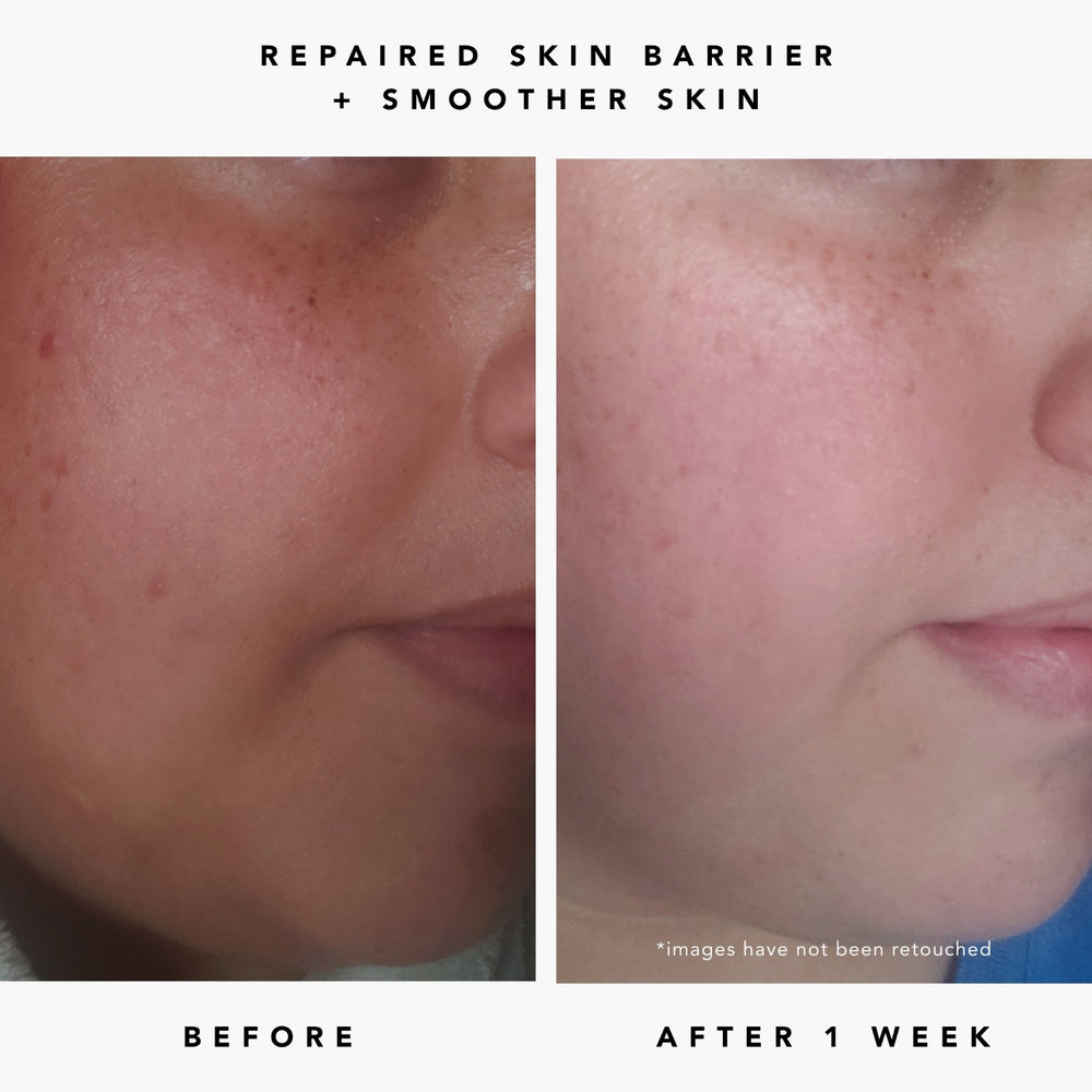 Herbivore Milky Way 10% AHA + Oat Soothing Exfoliating Serum - Deeply exfoliates the surface of skin for instant glow and repairs the skin barrier