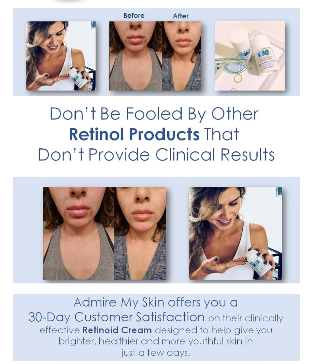 Admire My Skin Clinically Effective Retinoid Cream - Over The Counter Retinol - Anti Aging Retinol Cream Moisturizer, Eliminate Wrinkles
