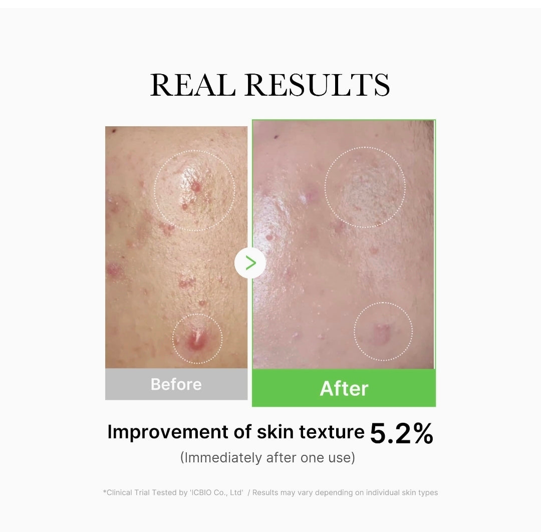 Medicube-Exosome Cica Serum - Enriquecido con 12 tipos de ingredientes de Cica y 2% de niacinamida, ofrece un efecto calmante para la piel irritada e ilumina la piel oscura.