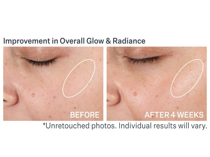 Strivectin Advanced Resurfacing Pro Glowfoliant Mix-In Microderm Crystals