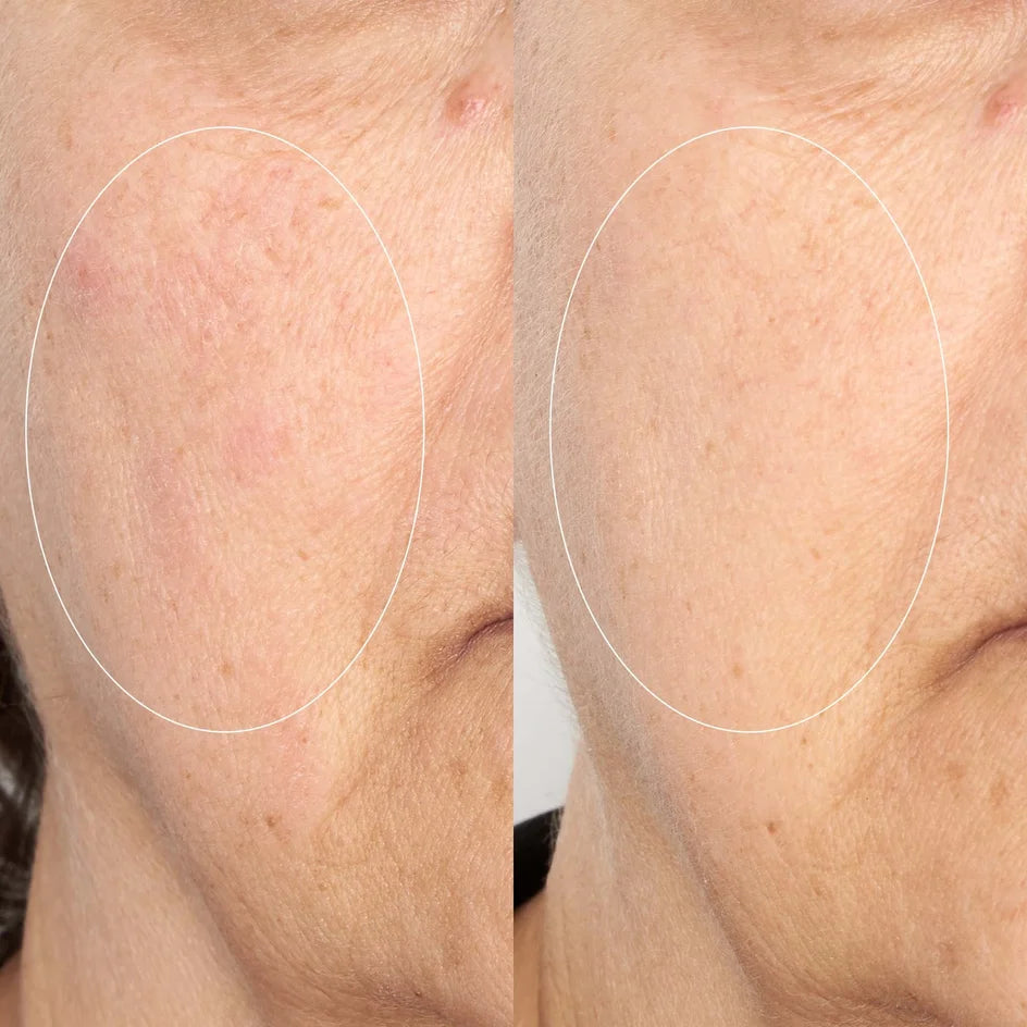 Perricone MD High Potency Intensive Smoothing Serum -
Visibly smooths rough skin texture for a more refined, even-looking complexion