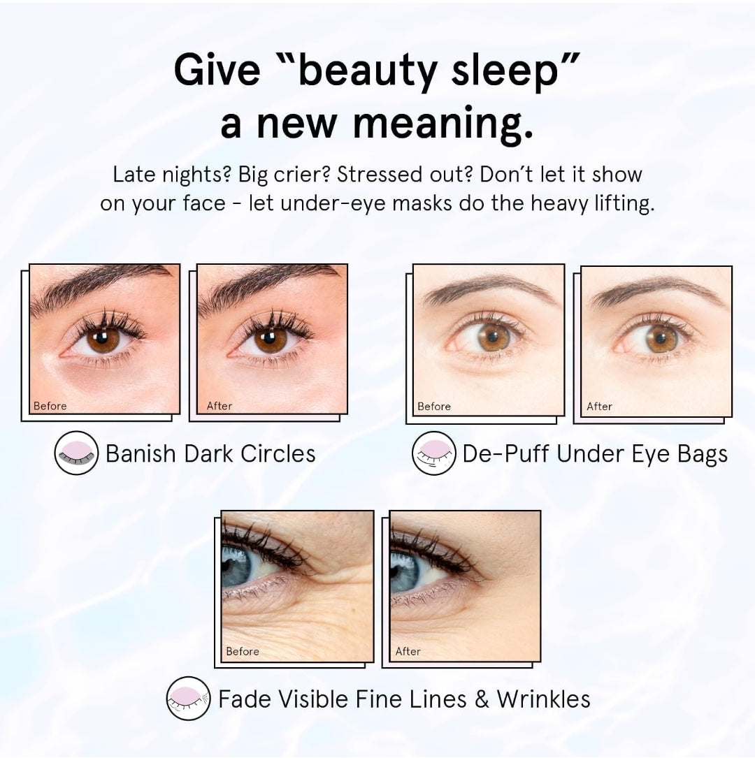 Grace & Stella Retinol Under Eye Patches - Gel Eye Mask with Hyaluronic Acid - For Puffiness, Brightening, Rejuvenating, Dark Circles, Hydrating, Moisturizing - 1 Pair