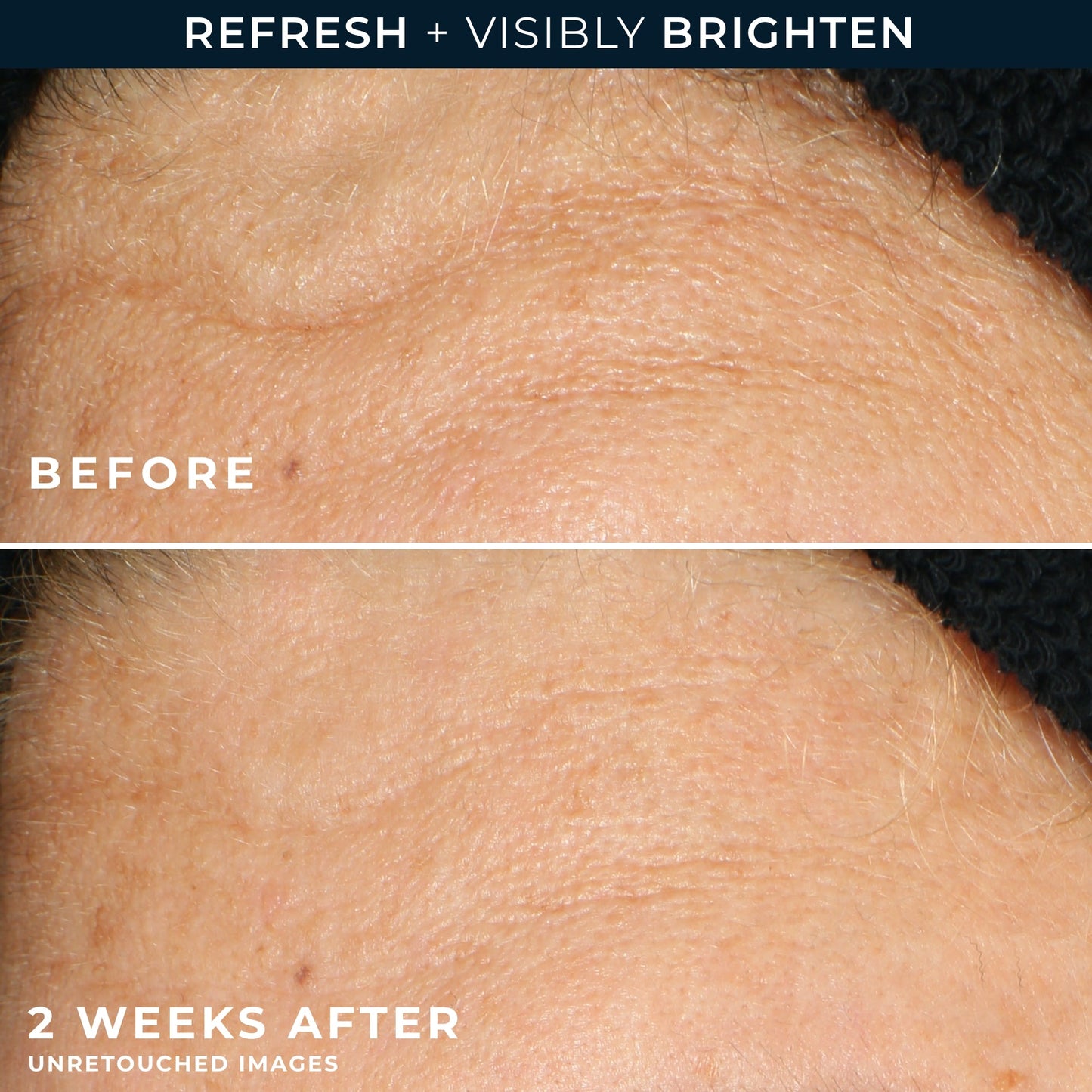 RoC MULTI CORREXION Revive + Glow Gel Cleanser - Cleanses, resurfaces, and extracts impurities