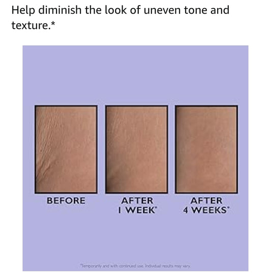 Peter Thomas Roth PRO Strength Stretch Mark Cream - Treatment For Body Stretch Marks, Uneven Tone and Texture, Moisturizing