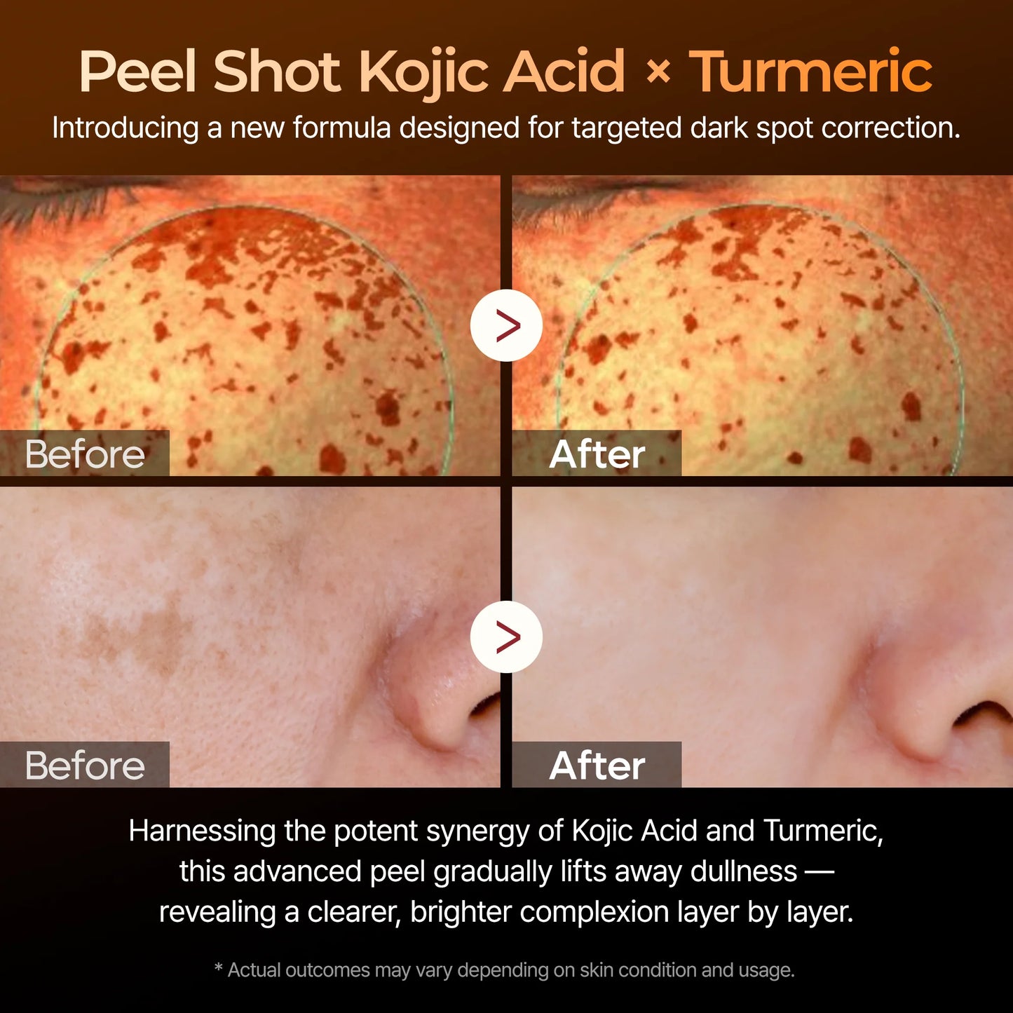 Dr.Melaxin Peel Shot Kojic Acid Turmeric Serum