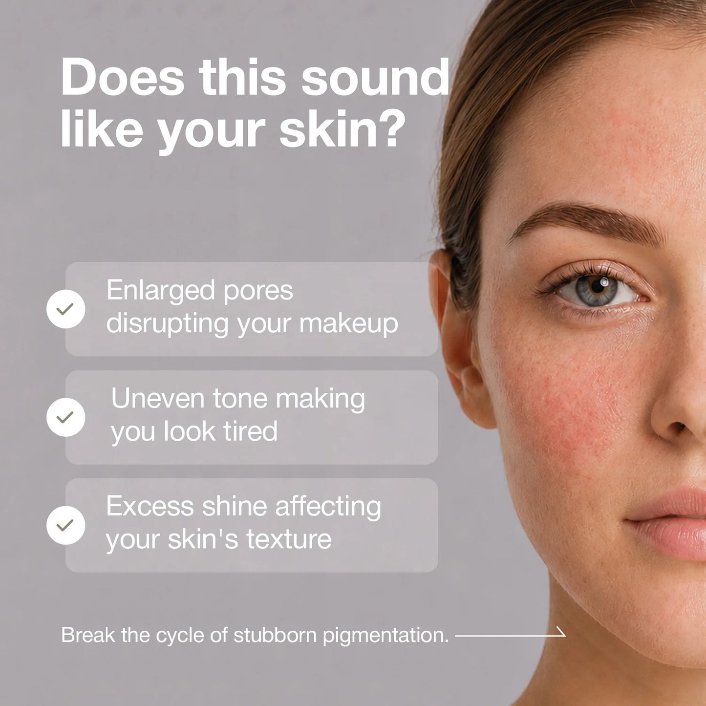 Nineless B-BOOST 22% Niacinamide Serum - Fades patchy discoloration to reveal an even, bright complexion