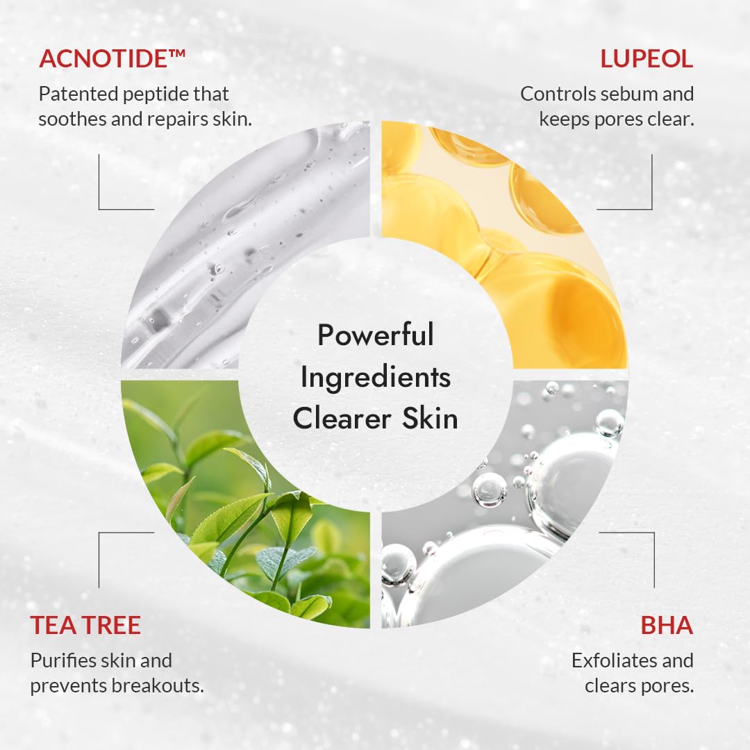 MIZON Good Bye Blemish Low pH Cleanser, Cleanser for troubled skin, Acne Treatment, Breakout Treatment, Korean Skincare, Acne Spot Treatment, Soothing for sensitive skin