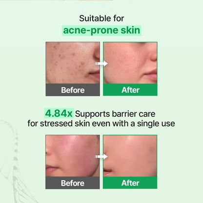 Zipiderm EGF Skin Barrier Cream Toner – Korean Milky Hydrating Toner for Dry, Sensitive & Acne-Prone Skin with Ceramides, Hyaluronic Acid, Rice Bran & Soy Protein, Moisturizing Skincare