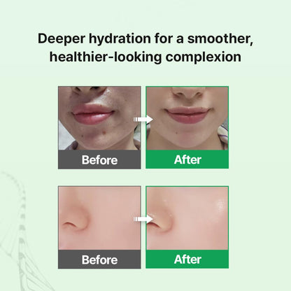 Zipiderm EGF Skin Barrier Serum, Lightweight Hydro Ampoule