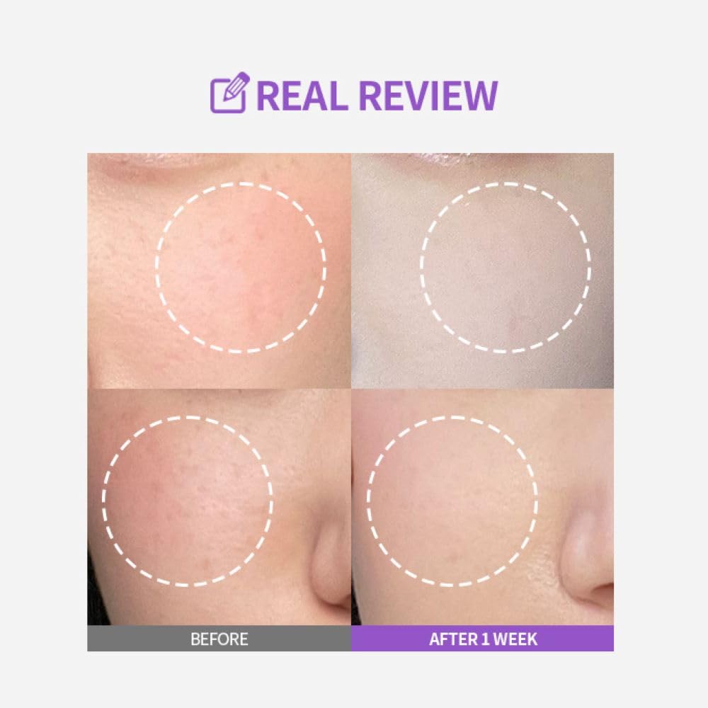 SUNGBOON EDITOR Meoru Podo Vita C Turn-over Ampoule - Niacinamide, Vitamin C